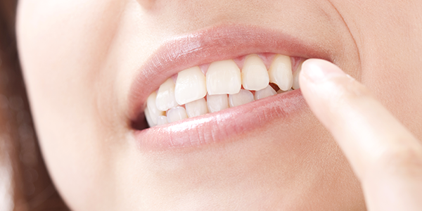 ホワイトニング